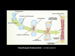 Ossoficação Endocondral – a mais comum
 