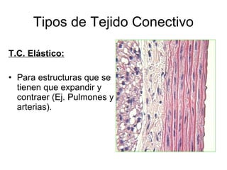 Tipos de Tejido Conectivo 
T.C. Elástico: 
• Para estructuras que se 
tienen que expandir y 
contraer (Ej. Pulmones y 
arterias). 
 