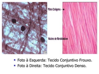 Foto à Esquerda: Tecido Conjuntivo Frouxo. Foto à Direita: Tecido Conjuntivo Denso. 
