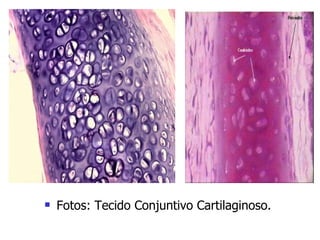 Fotos: Tecido Conjuntivo Cartilaginoso. 