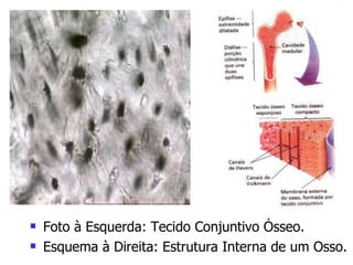 Foto à Esquerda: Tecido Conjuntivo Ósseo. Esquema à Direita: Estrutura Interna de um Osso. 