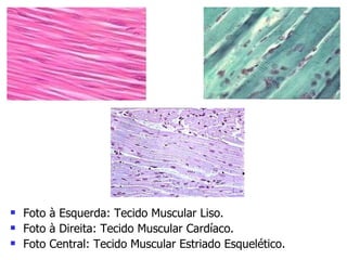 Foto à Esquerda: Tecido Muscular Liso. Foto à Direita: Tecido Muscular Cardíaco. Foto Central: Tecido Muscular Estriado Esquelético. 
