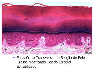 Foto: Corte Transversal de Secção de Pele Grossa mostrando Tecido Epitelial Estratificado.  