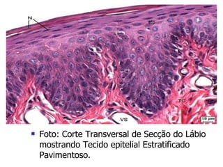 Foto: Corte Transversal de Secção do Lábio mostrando Tecido epitelial Estratificado Pavimentoso. 