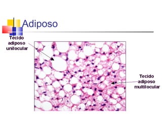 Adiposo
 