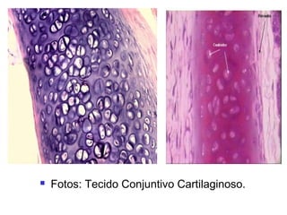  Fotos: Tecido Conjuntivo Cartilaginoso.
 