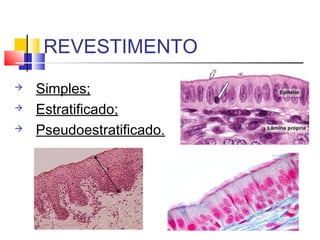 REVESTIMENTO
 Simples;
 Estratificado;
 Pseudoestratificado.
 