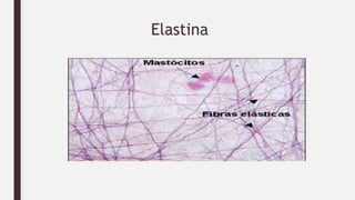 Elastina
 
