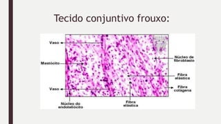 Tecido conjuntivo frouxo:
 