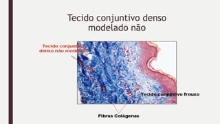 Tecido conjuntivo denso
modelado não
 