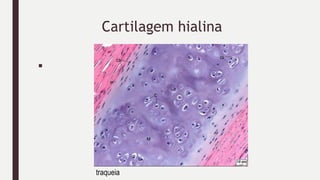 Cartilagem hialina
■
traqueia
 