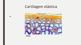 Cartilagem elástica
■
orelha
 