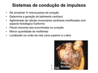 Sistemas de condução de impulsos
• Nó sinoatrial  marca-passo do coração
• Determina a geração do batimento cardíaco
• Aglomerado de células musculares cardíacas modificadas com
aspecto histológico fusiforme
• Fibras menores das encontradas no coração
• Menor quantidade de miofibrilas
• Localizado na união da veia cava superior e o átrio
 