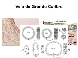 Veia grande calibre
Veia de Grande Calibre
 