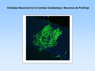 Citotipia Neuronal de la Corteza Cerebelosa: Neurona de Purkinje
 