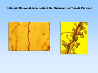 Citotipia Neuronal de la Corteza Cerebelosa: Neurona de Purkinje
 