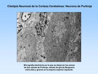 Citotipia Neuronal de la Corteza Cerebelosa: Neurona de Purkinje




            Micrografía electrónica en la que se observan los somas
            de dos células de Purkinje, células de glia de Bergmann
             entre ellas y granos en la esquina superior izquierda
 