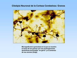 Citotipia Neuronal de la Corteza Cerebelosa: Granos




         Micrografía de la granulosa en la que se muestra
         el soma de los granos con sus prolongaciones
         dendríticas terminadas "en garra" y el comienzo
         de sus axones (Golgi)
 