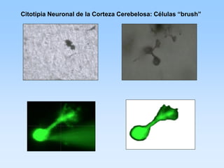 Citotipia Neuronal de la Corteza Cerebelosa: Células “brush”
 