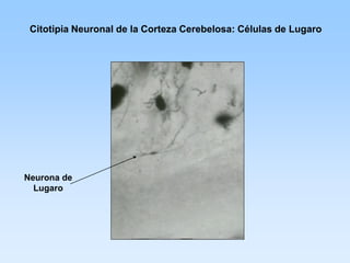 Citotipia Neuronal de la Corteza Cerebelosa: Células de Lugaro




Neurona de
  Lugaro
 