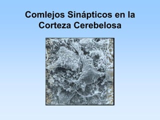 Comlejos Sinápticos en la
  Corteza Cerebelosa
 