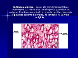 Cartilagem elástica – possui alto teor de fibras elásticas
  (elastina) em sua matriz, mas também pouca quantidade de
colágeno. Esse tipo é encontrado no aparelho auditivo, formando
   o pavilhão externo da orelha, na laringe e na válvula
                           epiglote.
 