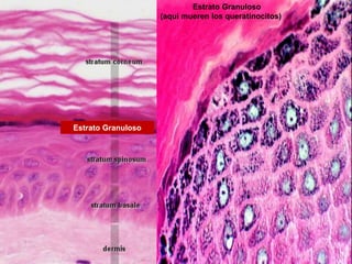 Estrato Granuloso
Estrato Granuloso
(aquí mueren los queratinocitos)
 