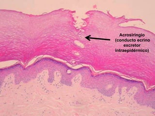 Acrosiringio
(conducto ecrino
excretor
intraepidérmico)
 