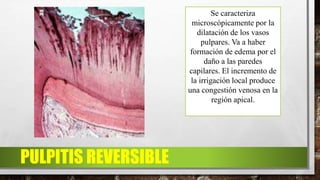 PULPITIS REVERSIBLE
Se caracteriza
microscópicamente por la
dilatación de los vasos
pulpares. Va a haber
formación de edema por el
daño a las paredes
capilares. El incremento de
la irrigación local produce
una congestión venosa en la
región apical.
 