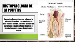 HISTOPATOLOGIA DE
LA PULPITIS
Los estímulos nocivos que originan la
inflamación pulpar son muchos y de
muy variada índole , sin duda la invasión
bacteriana proveniente de la caries es
la más frecuente causa de patología
pulpar.
 