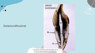 Gorte konØitudinal
Descargado por Andre Novais (novaismedicina@hotmail.com)
Encuentra más documentos en www.udocz.com
 