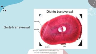 Gorte transversal
Descargado por Andre Novais (novaismedicina@hotmail.com)
Encuentra más documentos en www.udocz.com
 