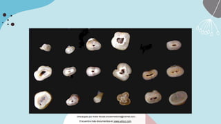 Descargado por Andre Novais (novaismedicina@hotmail.com)
Encuentra más documentos en www.udocz.com
 