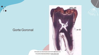 Gorte Goronal
Descargado por Andre Novais (novaismedicina@hotmail.com)
Encuentra más documentos en www.udocz.com
 