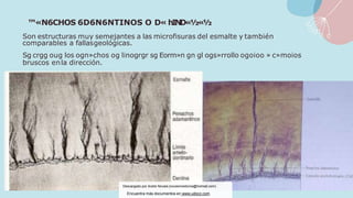 ™«N6CHOS 6D6N6NTINOS O D« hIND«½«½
Son estructuras muy semejantes a las microfisuras del esmalte y también
comparables a fallasgeológicas.
Sg crgg oug los ogn»chos og linogrgr sg Eorm»n gn gl ogs»rrollo ogoioo » c»moios
bruscos enla dirección.
Descargado por Andre Novais (novaismedicina@hotmail.com)
Encuentra más documentos en www.udocz.com
 
