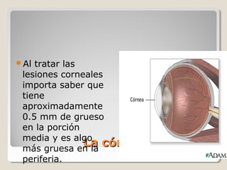 Al tratar las
 lesiones corneales
 importa saber que
 tiene
 aproximadamente
 0.5 mm de grueso
 en la porción
 media y es algo
               La córnea
 más gruesa en la
 periferia.
 