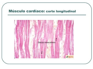 Músculo cardíaco: corte longitudinal
Discos intercalares
 