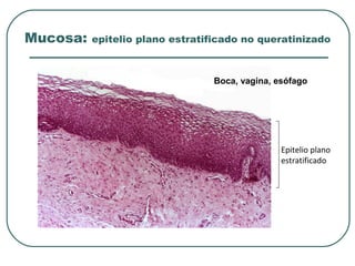 Mucosa: epitelio plano estratificado no queratinizado
Epitelio plano
estratificado
Boca, vagina, esófago
 