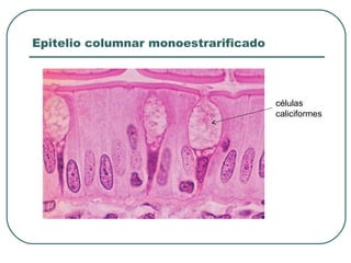 Epitelio columnar monoestrarificado
células
caliciformes
 