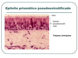 Epitelio prismático pseudoestratificado
cilios
Epitelio
pseudoestratifi-
cado
Tráquea, bronquios
 
