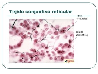 Tejido conjuntivo reticular
Fibras
reticulares
Células
plasmáticas
 