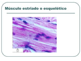 Músculo estriado o esquelético
 