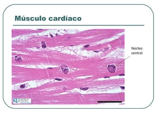 Músculo cardíaco
Núcleo
central
 