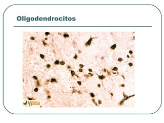 Oligodendrocitos
 