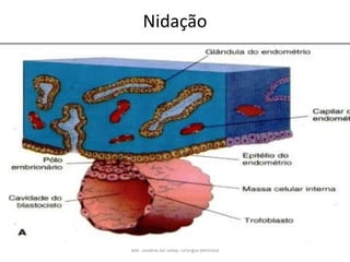 Nidação




Me. Juliana da Silva/ cirurgiã dentista
 