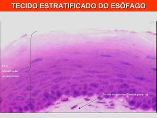 TECIDO ESTRATIFICADO DO ESÔFAGO 
