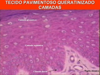 TECIDO PAVIMENTOSO QUERATINIZADO CAMADAS 