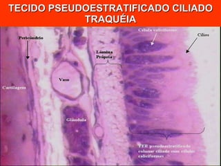TECIDO PSEUDOESTRATIFICADO CILIADO TRAQUÉIA 