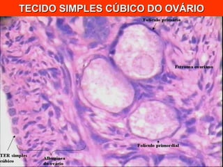 TECIDO SIMPLES CÚBICO DO OVÁRIO 