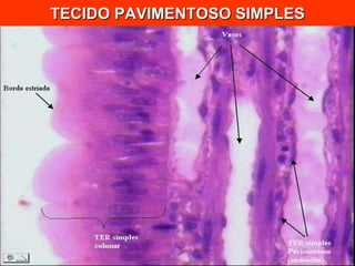 TECIDO PAVIMENTOSO SIMPLES 